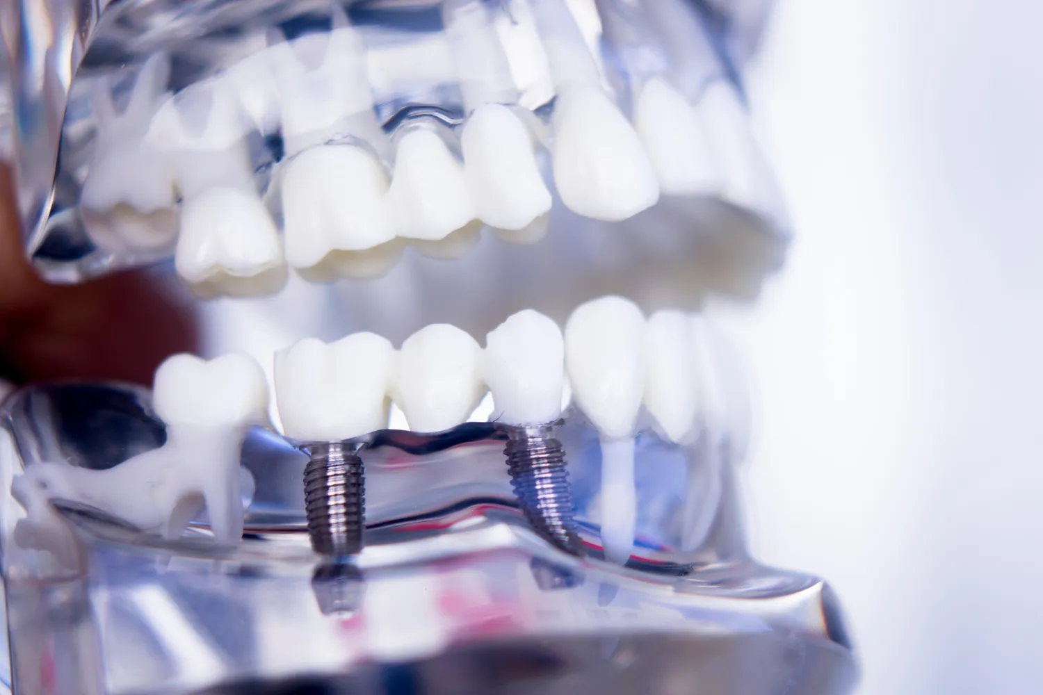 Endodoncja mikroskopowa szczecin